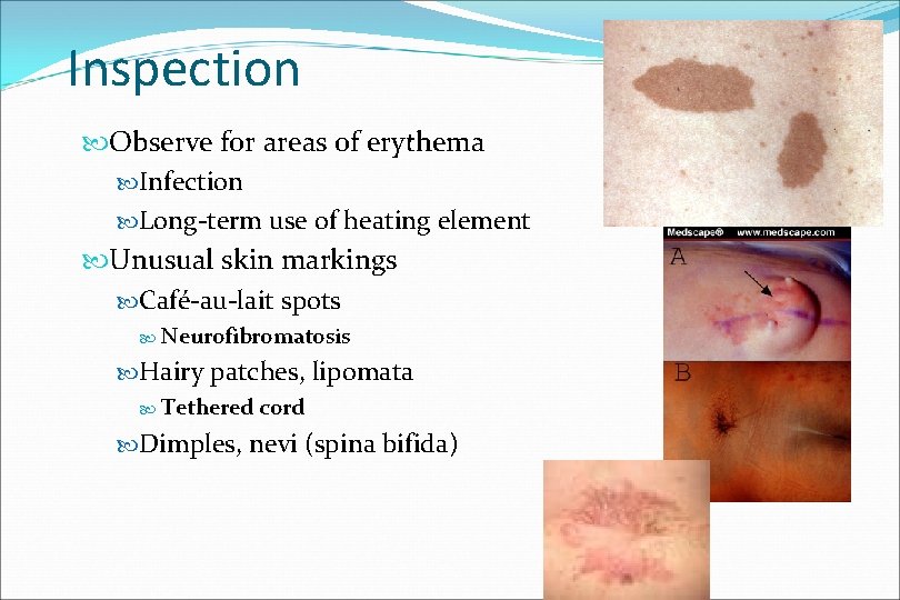 Inspection Observe for areas of erythema Infection Long-term use of heating element Unusual skin