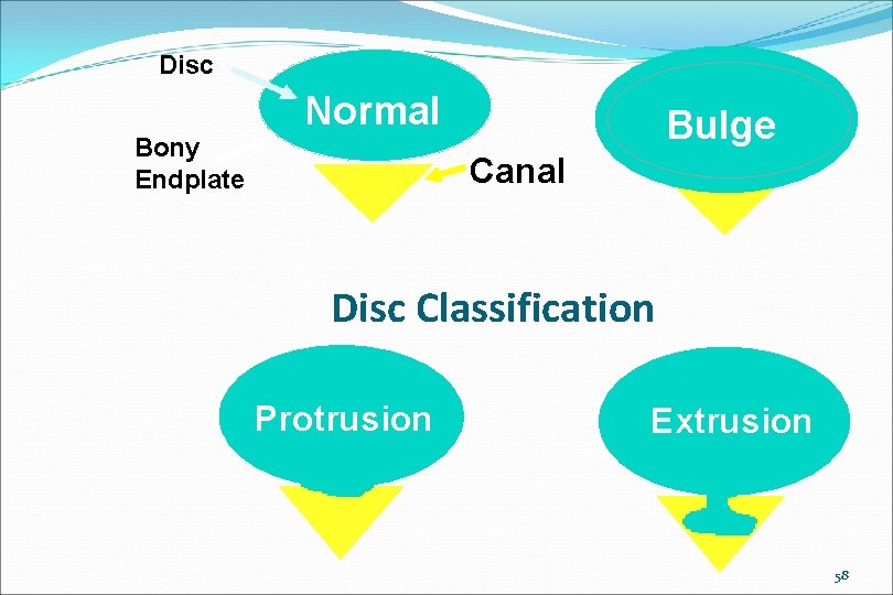 Disc Normal Bony Endplate Bulge Canal Disc Classification Protrusion Extrusion 58 
