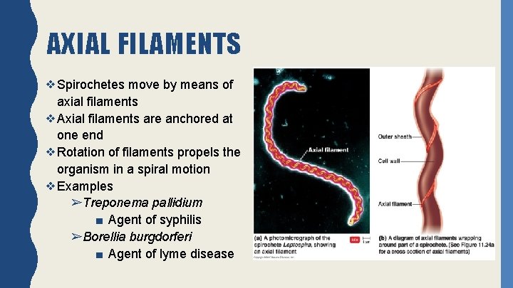 AXIAL FILAMENTS ❖Spirochetes move by means of axial filaments ❖Axial filaments are anchored at