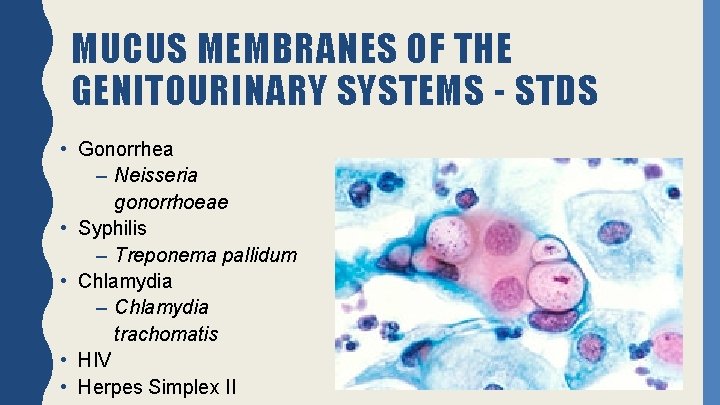 MUCUS MEMBRANES OF THE GENITOURINARY SYSTEMS - STDS • Gonorrhea – Neisseria gonorrhoeae •