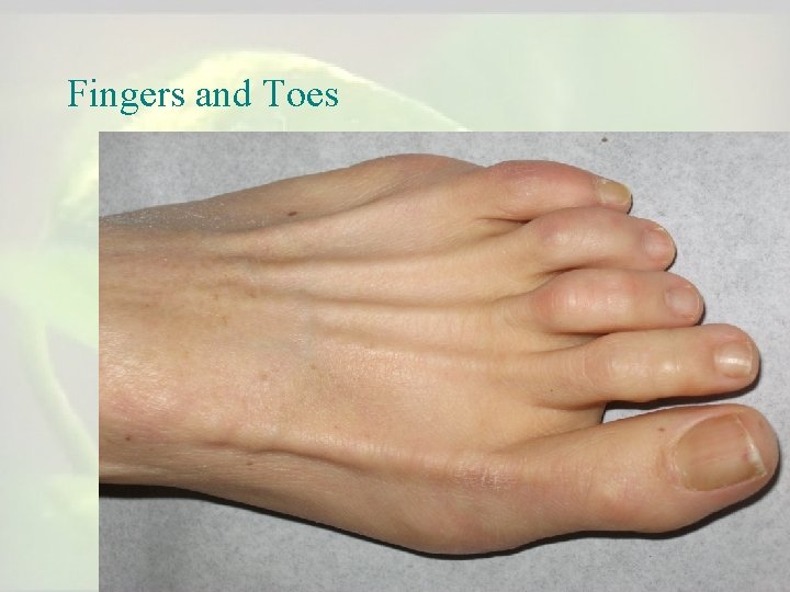 Fingers and Toes Fingers and Toes