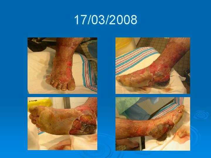 17/03/2008 17/03/2008