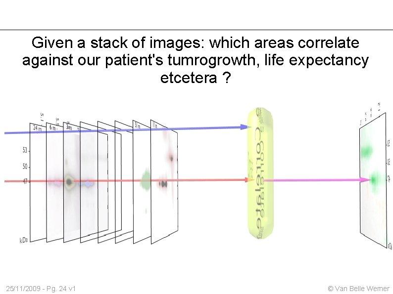 Given a stack of images: which areas correlate against our patient's tumrogrowth, life expectancy