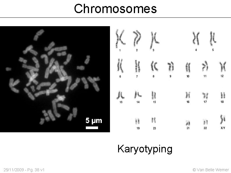 Chromosomes Karyotyping 25/11/2009 - Pg. 38 v 1 © Van Belle Werner 