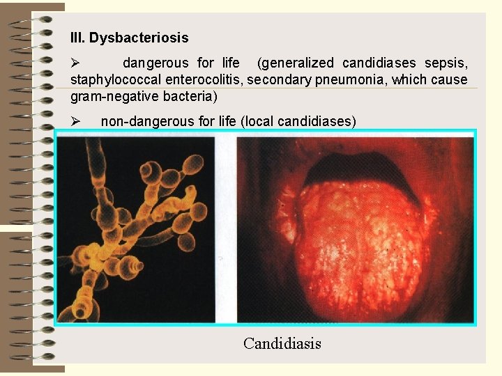 ІІІ. Dysbacteriosis Ø dangerous for life (generalized candidiases sepsis, staphylococcal enterocolitis, secondary pneumonia, which