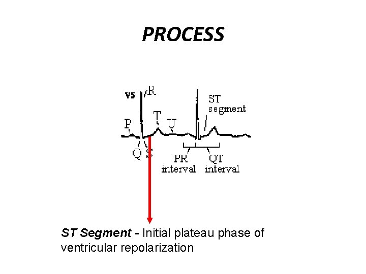PROCESS ST Segment - Initial plateau phase of ventricular repolarization 