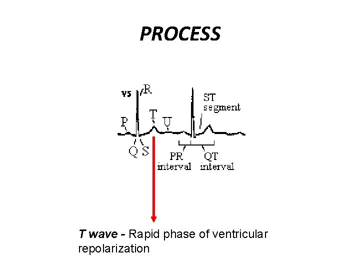 PROCESS T wave - Rapid phase of ventricular repolarization 