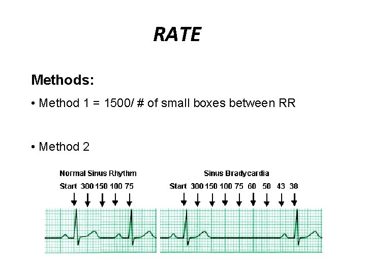 RATE Methods: • Method 1 = 1500/ # of small boxes between RR •