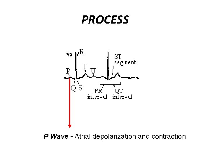 PROCESS P Wave - Atrial depolarization and contraction 