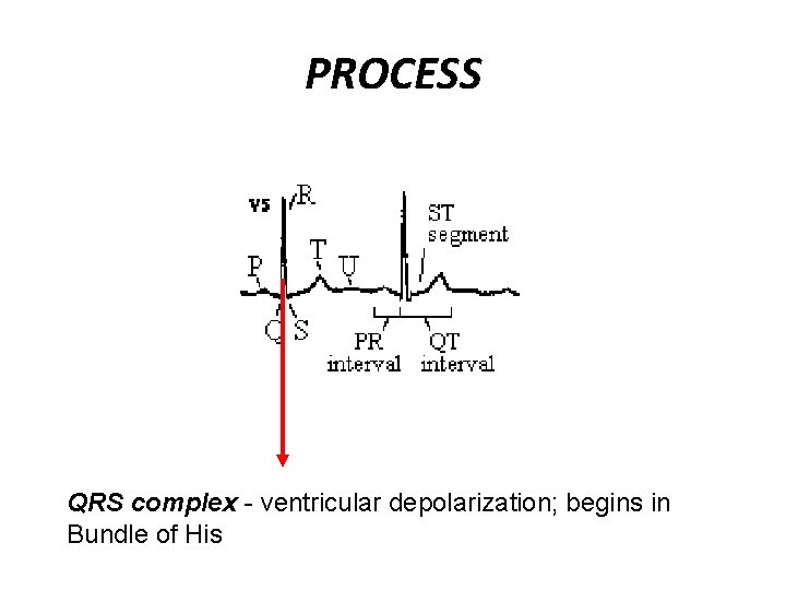 PROCESS QRS complex - ventricular depolarization; begins in Bundle of His 