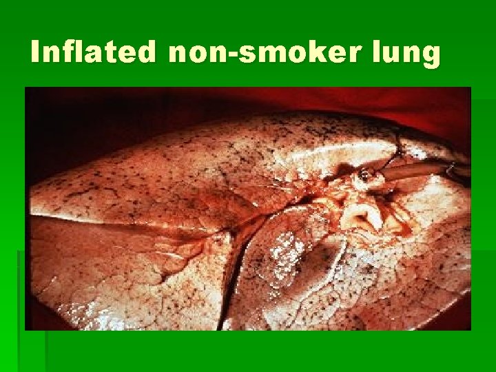 Inflated non-smoker lung 