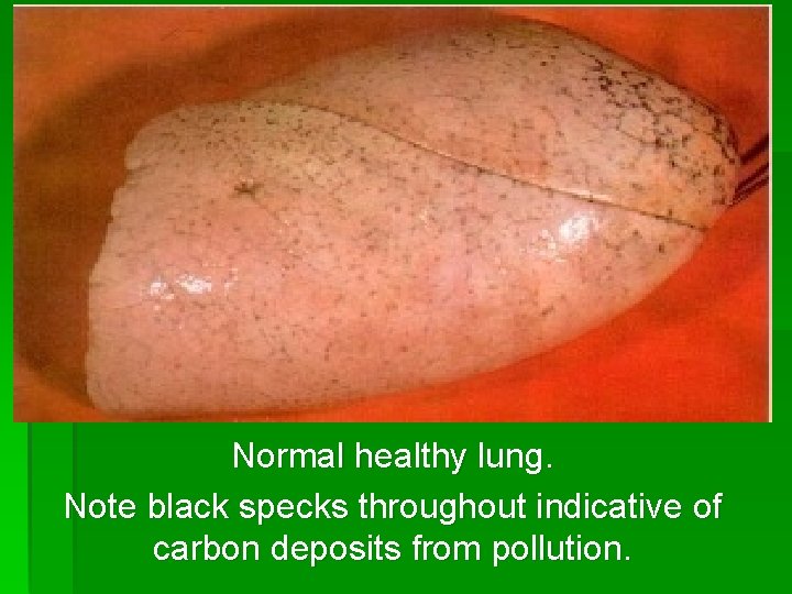 Normal healthy lung. Note black specks throughout indicative of carbon deposits from pollution. 