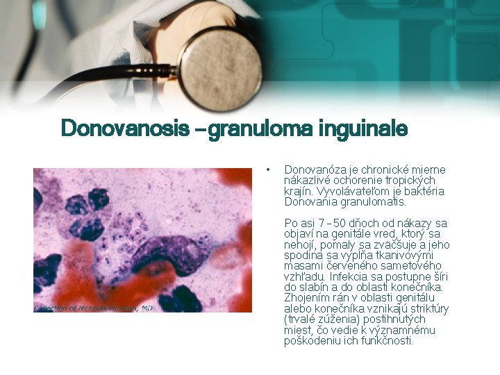 Donovanosis – granuloma inguinale • Donovanóza je chronické mierne nákazlivé ochorenie tropických krajín. Vyvolávateľom