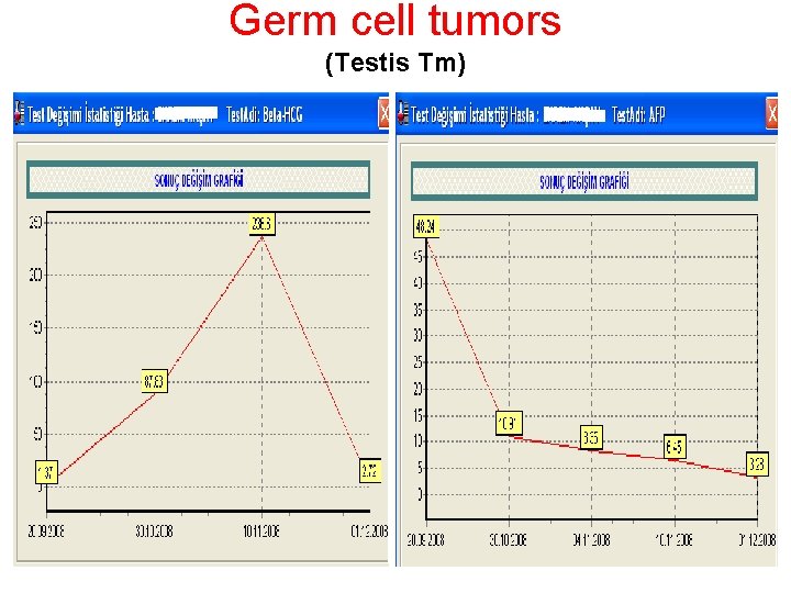 Germ cell tumors (Testis Tm) 