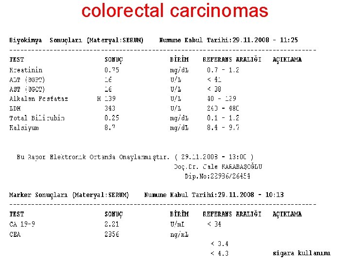 colorectal carcinomas 