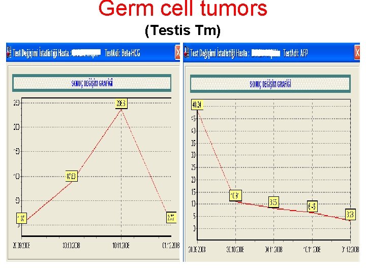 Germ cell tumors (Testis Tm) 