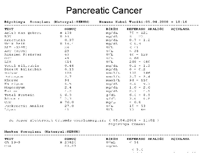 Pancreatic Cancer 