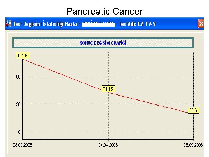 Pancreatic Cancer 
