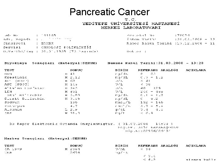 Pancreatic Cancer 