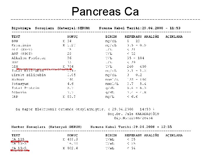 Pancreas Ca 