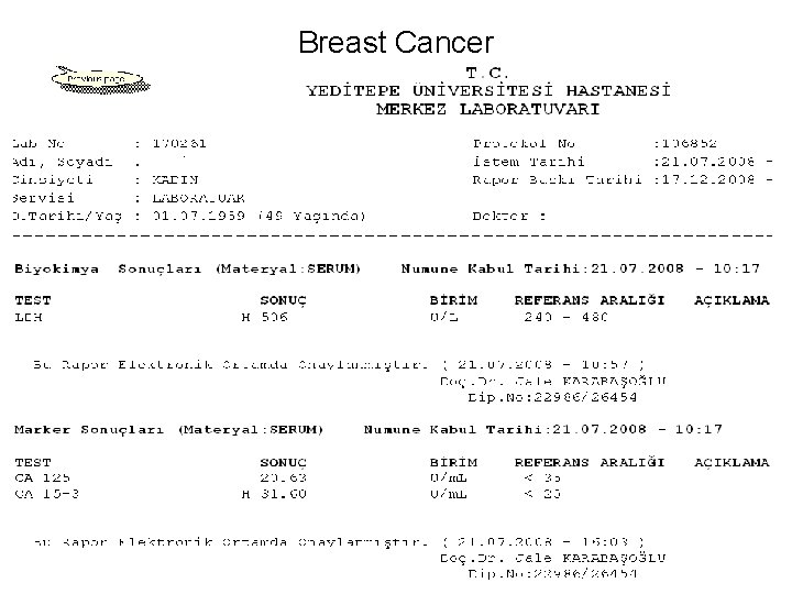 Breast Cancer 