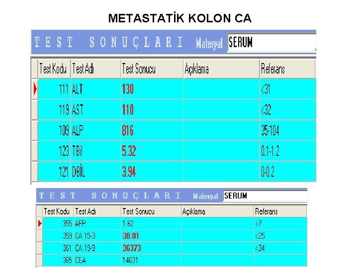 METASTATİK KOLON CA 