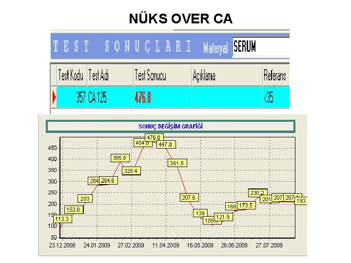 NÜKS OVER CA 