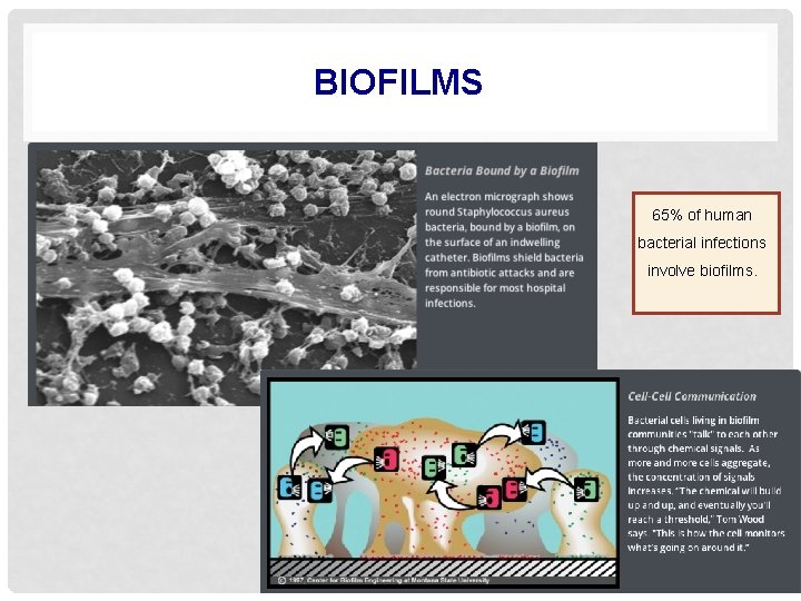 BIOFILMS 65% of human bacterial infections involve biofilms. 