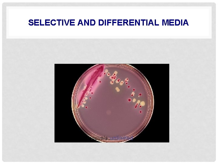 SELECTIVE AND DIFFERENTIAL MEDIA 