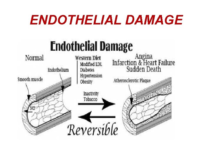 ENDOTHELIAL DAMAGE 