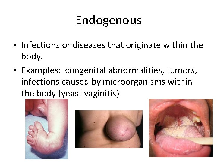 Endogenous • Infections or diseases that originate within the body. • Examples: congenital abnormalities,