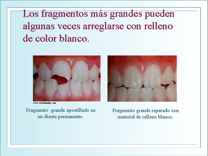 Los fragmentos más grandes pueden algunas veces arreglarse con relleno de color blanco. www.