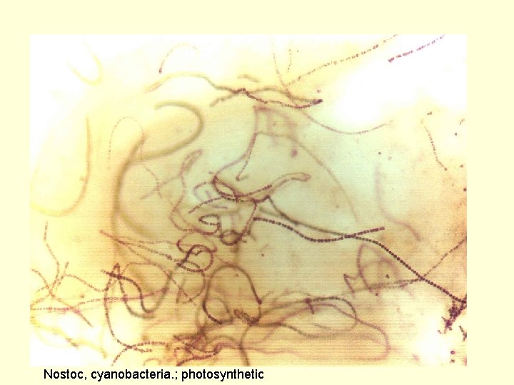 Nostoc, cyanobacteria. ; photosynthetic 