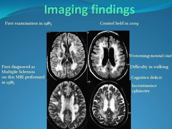 Imaging findings First examination in 1985 Control held in 2009 Worsening mental statu First