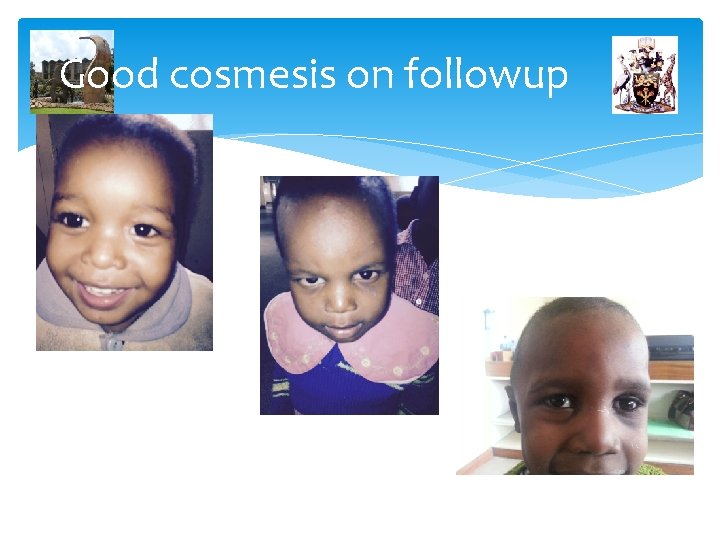 Good cosmesis on followup 