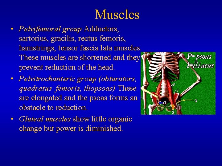 Muscles • Pelvifemoral group Adductors, sartorius, gracilis, rectus femoris, hamstrings, tensor fascia lata muscles.