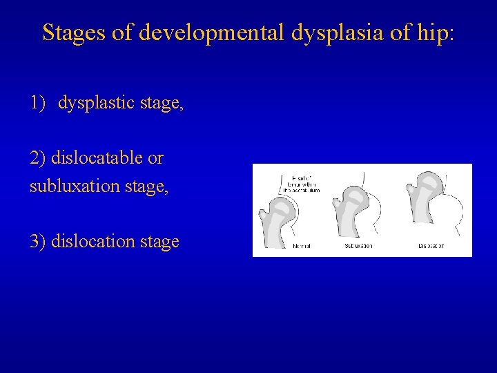 Stages of developmental dysplasia of hip: 1) dysplastic stage, 2) dislocatable or subluxation stage,