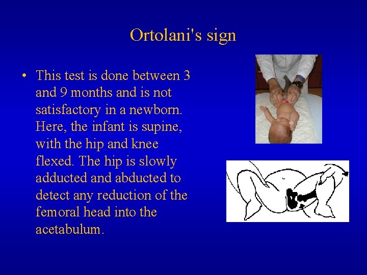 Ortolani's sign • This test is done between 3 and 9 months and is