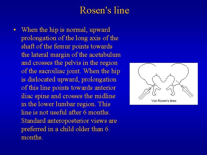 Rosen's line • When the hip is normal, upward prolongation of the long axis