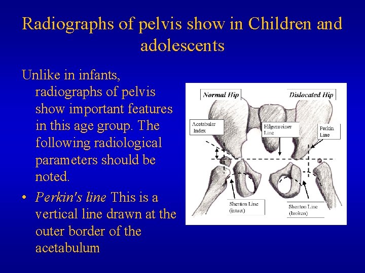 Radiographs of pelvis show in Children and adolescents Unlike in infants, radiographs of pelvis