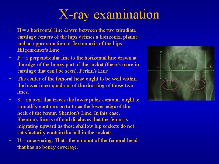 X-ray examination • • • H = a horizontal line drawn between the two