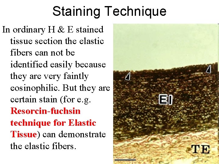 Staining Technique In ordinary H & E stained tissue section the elastic fibers can