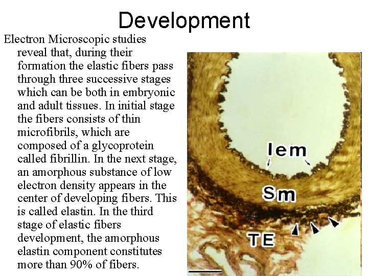 Development Electron Microscopic studies reveal that, during their formation the elastic fibers pass through Development Electron Microscopic studies reveal that, during their formation the elastic fibers pass through