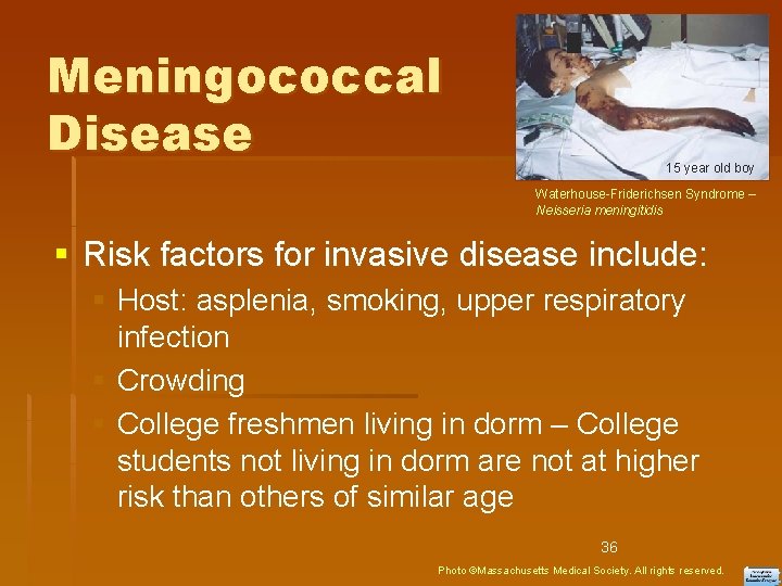 Meningococcal Disease 15 year old boy Waterhouse-Friderichsen Syndrome – Neisseria meningitidis Risk factors for