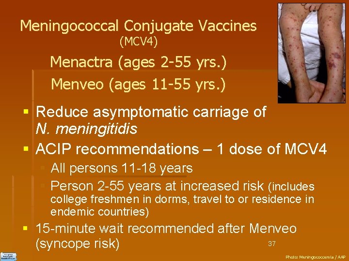 Meningococcal Conjugate Vaccines (MCV 4) Menactra (ages 2 -55 yrs. ) Menveo (ages 11