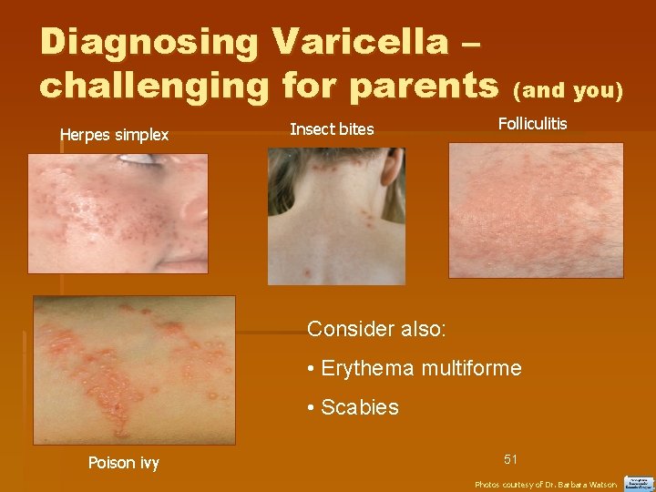 Diagnosing Varicella – challenging for parents Herpes simplex Insect bites (and you) Folliculitis Consider