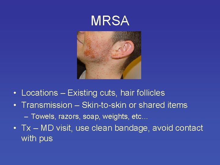 MRSA • Locations – Existing cuts, hair follicles • Transmission – Skin-to-skin or shared