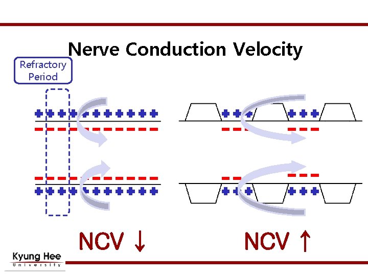Refractory Period Nerve Conduction Velocity NCV ↓ NCV ↑ 