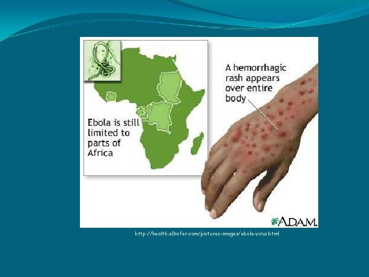 http: //health. allrefer. com/pictures-images/ebola-virus. html 