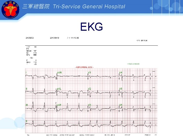 EKG 